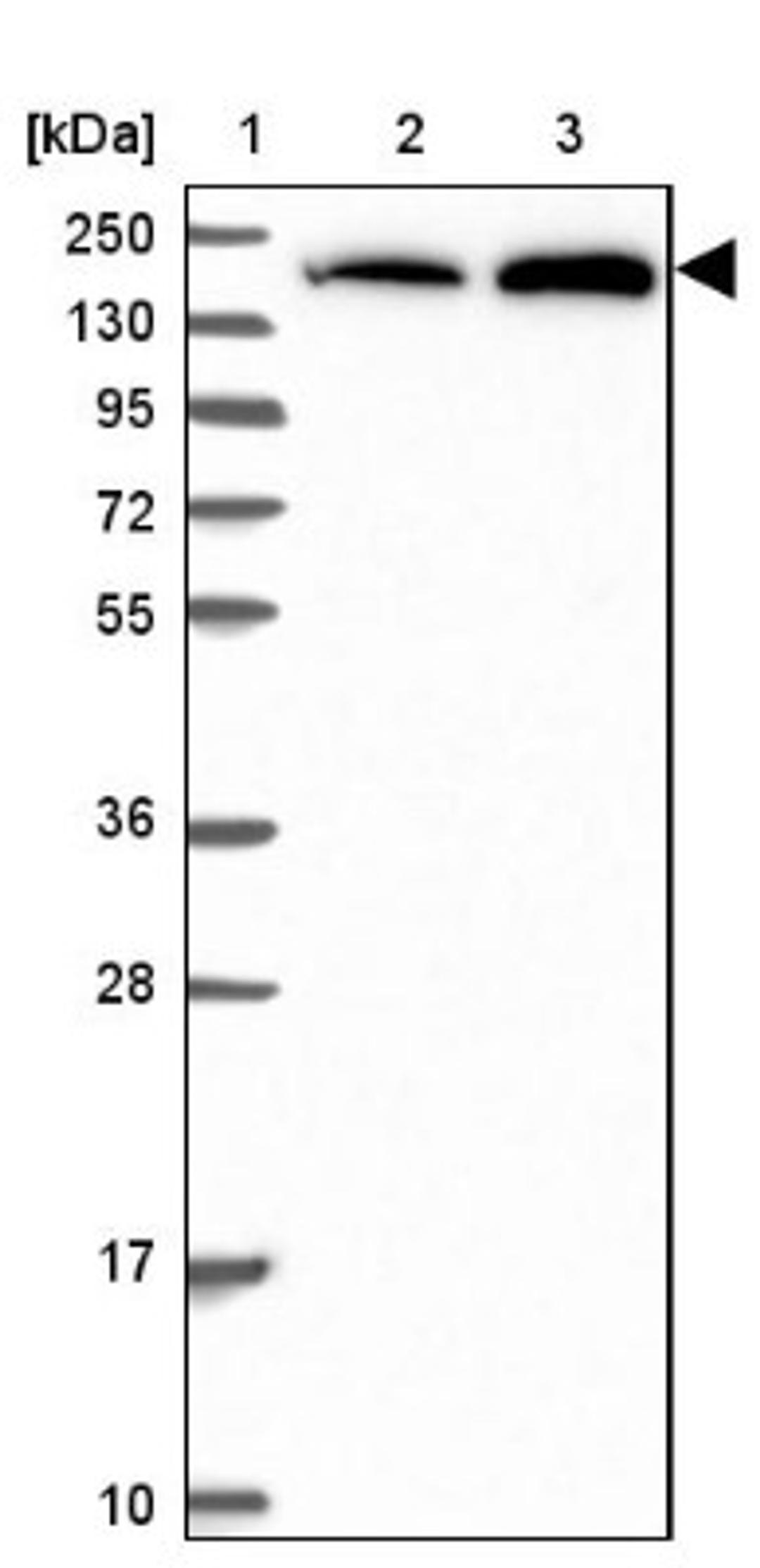 Western Blot: SAP155 Antibody [NBP2-47291] - Lane 1: Marker [kDa] 250, 130, 95, 72, 55, 36, 28, 17, 10.  Lane 2: Human cell line RT-4.  Lane 3: Human cell line U-251MG.