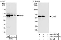 Detection of human LMP1 by western blot and immunoprecipitation.