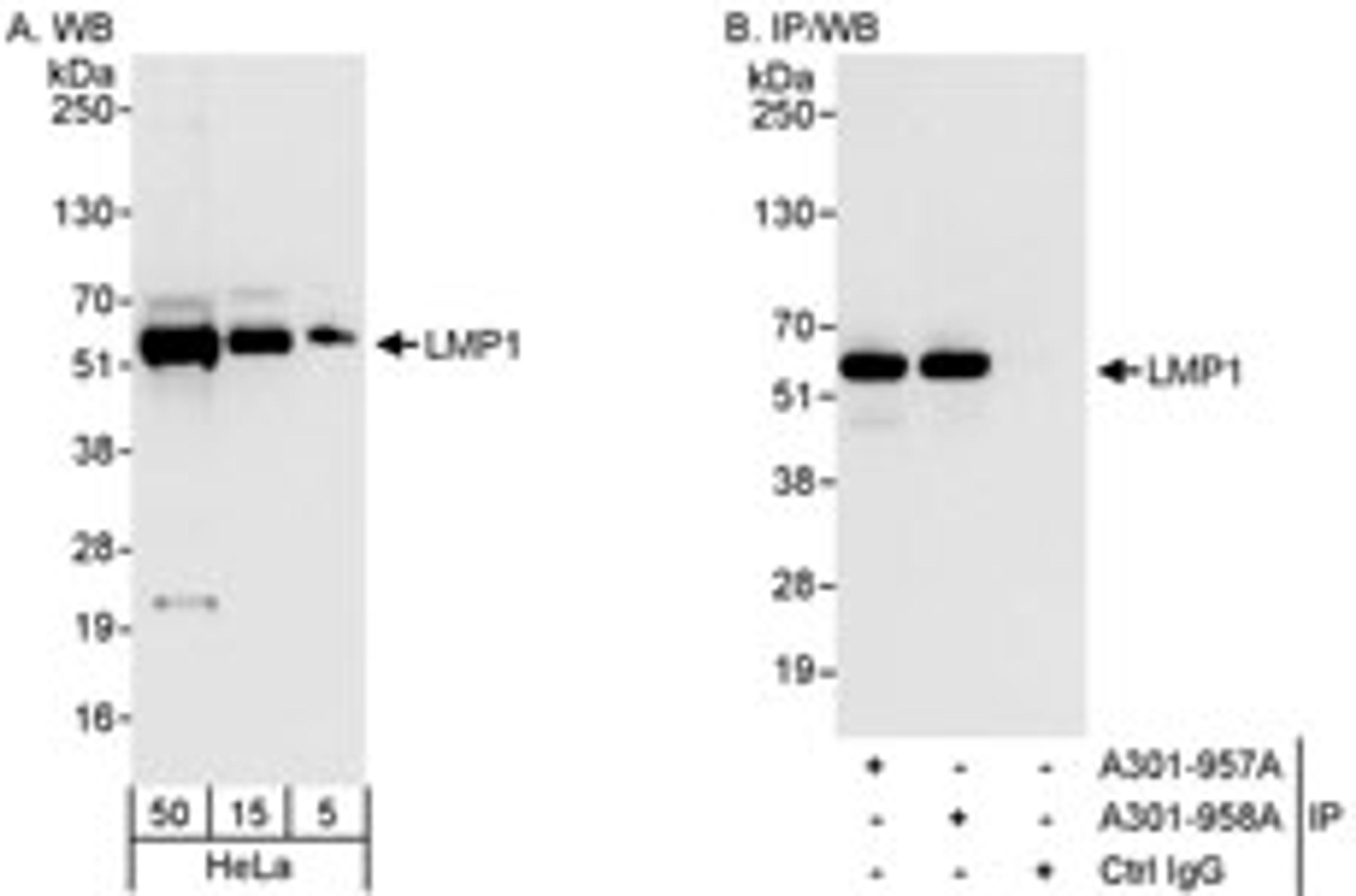 Detection of human LMP1 by western blot and immunoprecipitation.