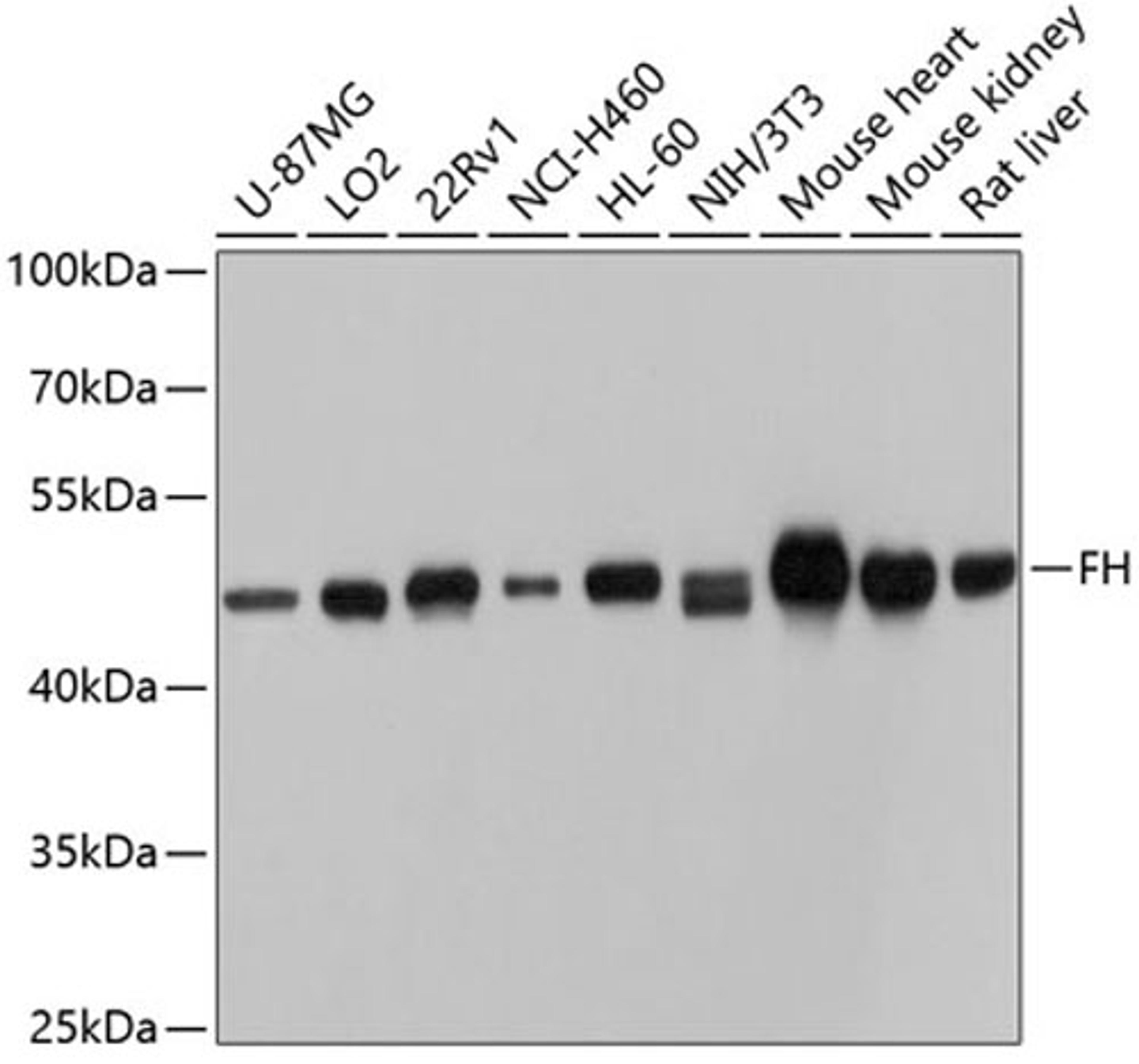 Western blot - FH antibody (A5688)