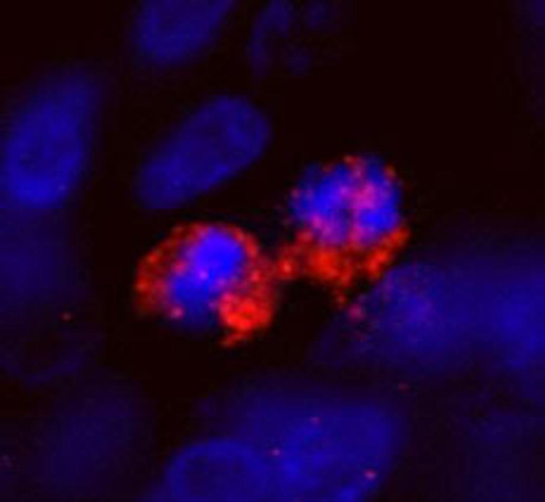 Detection of human CENP-F/Mitosin by IHC-IF.