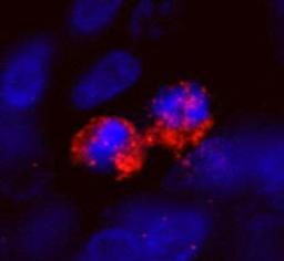 Detection of human CENP-F/Mitosin by IHC-IF.