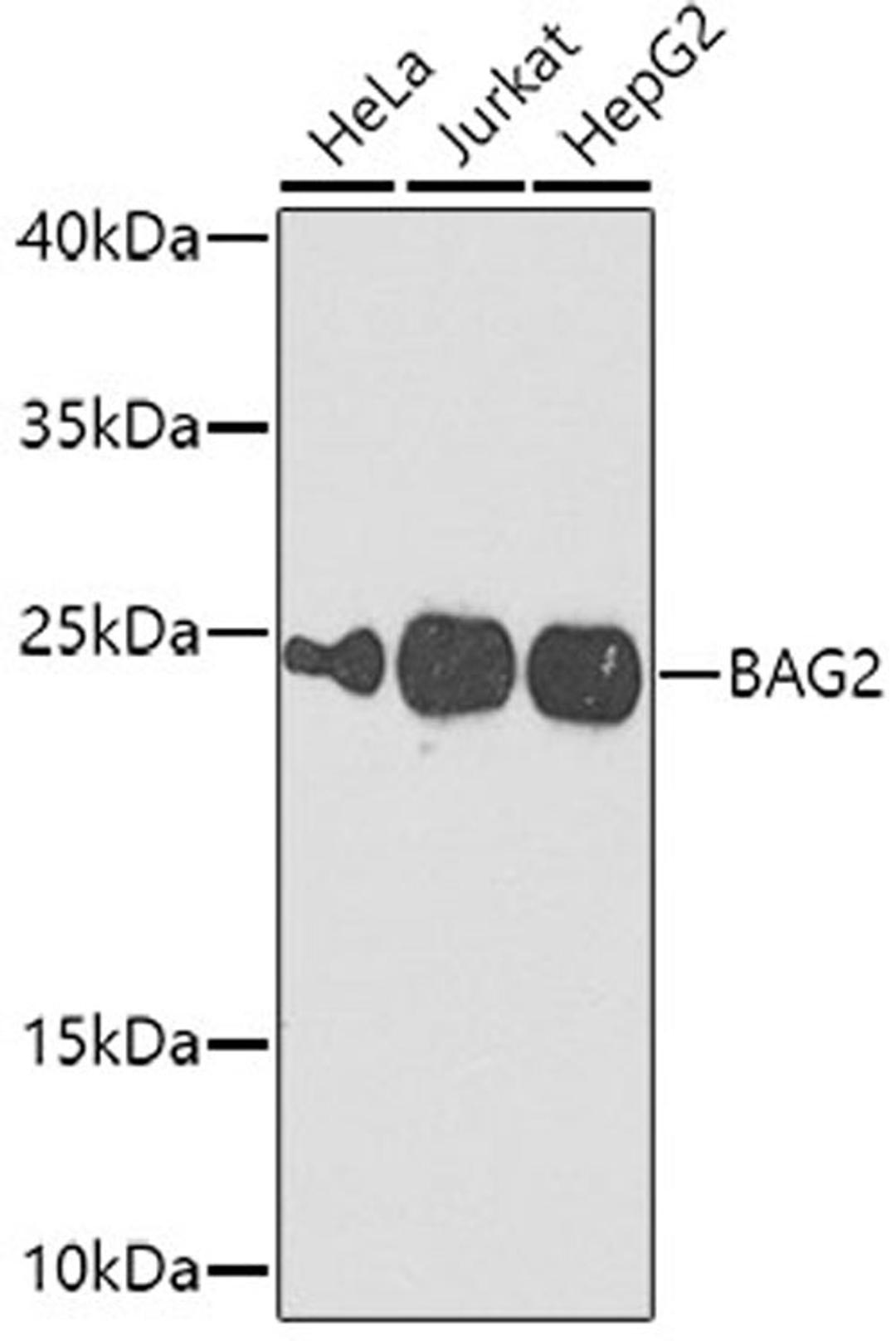 Western blot - BAG2 antibody (A7763)