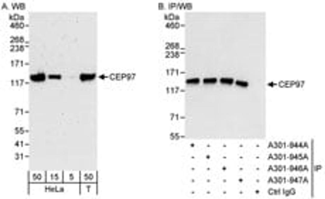 Detection of human CEP97 by western blot and immunoprecipitation.