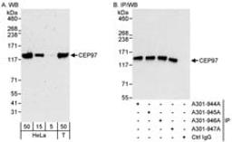 Detection of human CEP97 by western blot and immunoprecipitation.