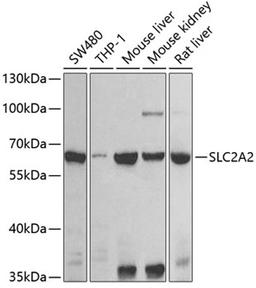 Western blot - SLC2A2 antibody (A9843)