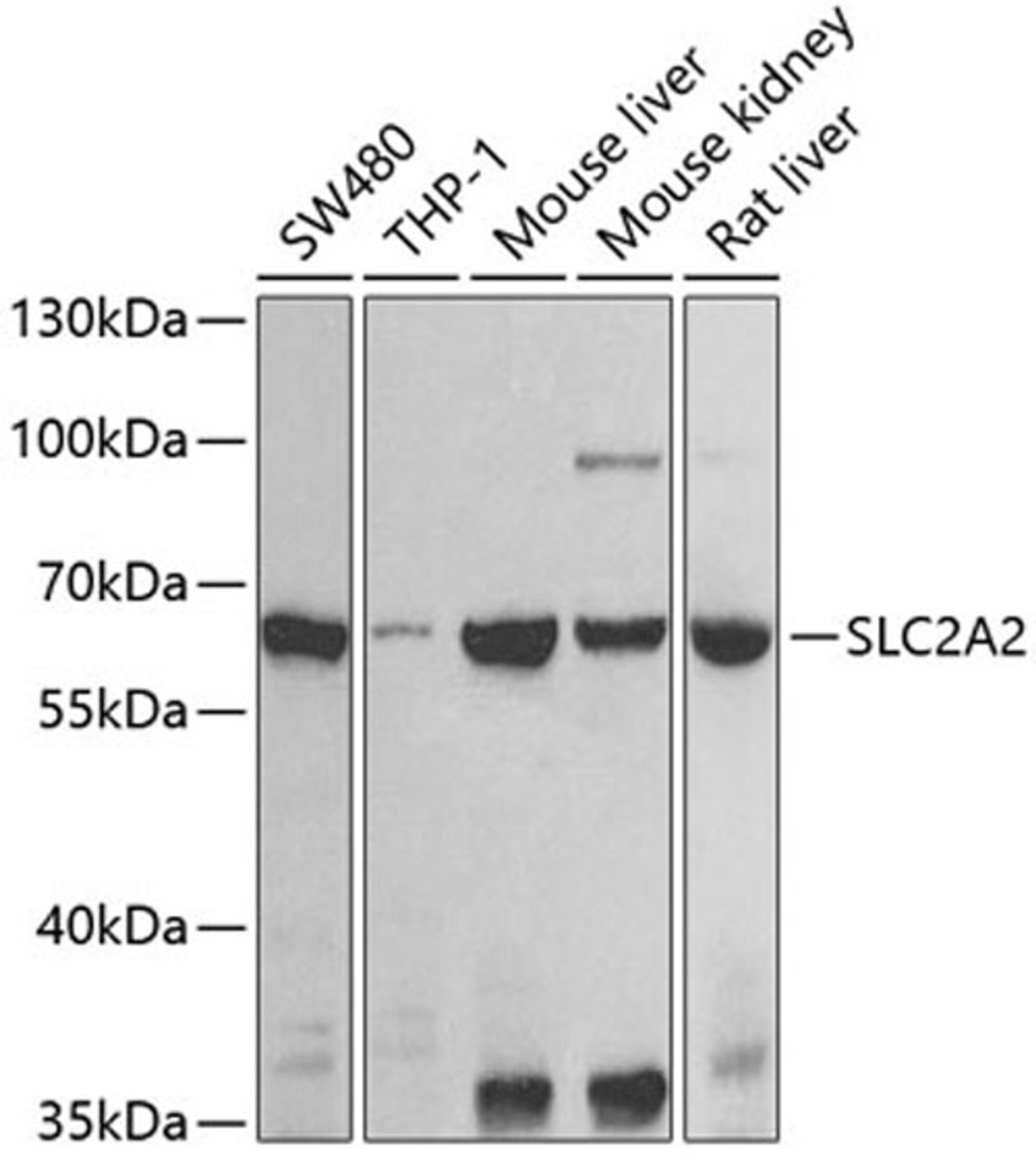 Western blot - SLC2A2 antibody (A9843)