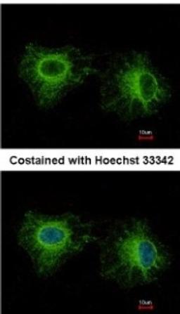 Immunocytochemistry/Immunofluorescence: Fast skeletal myosin light chain 1 Antibody [NBP2-16433] - Analysis of paraformaldehyde-fixed HeLa, using antibody at 1:500 dilution.