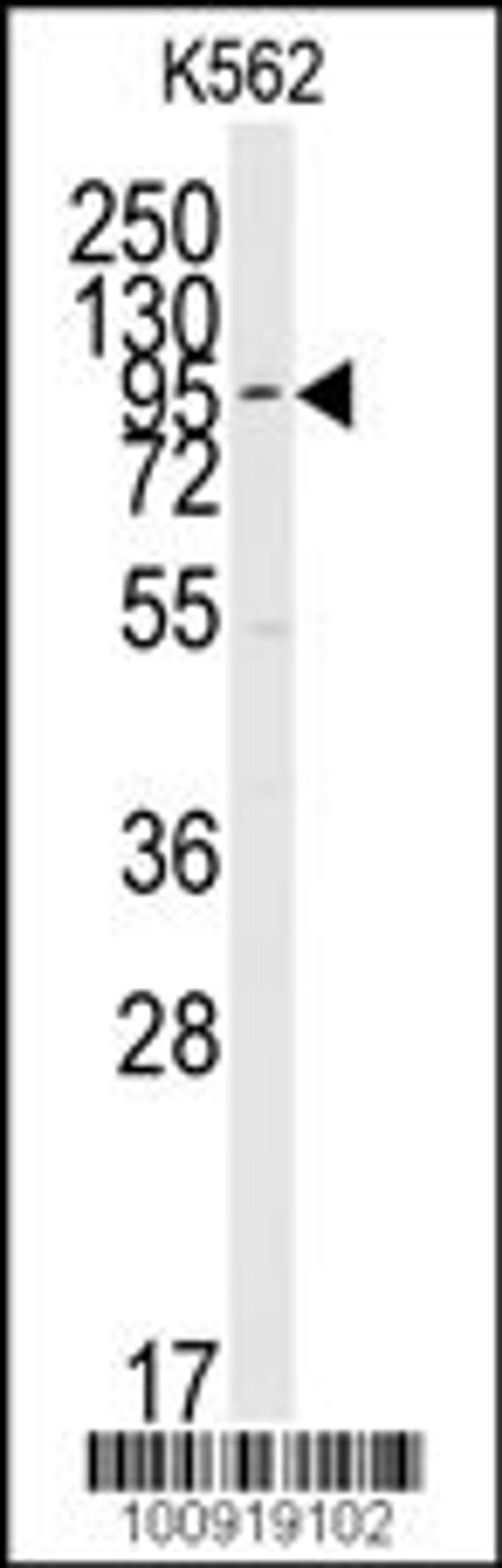 Western blot analysis of anti-ERK5 C-term Pab in K562 cell line lysates (35ug/lane)