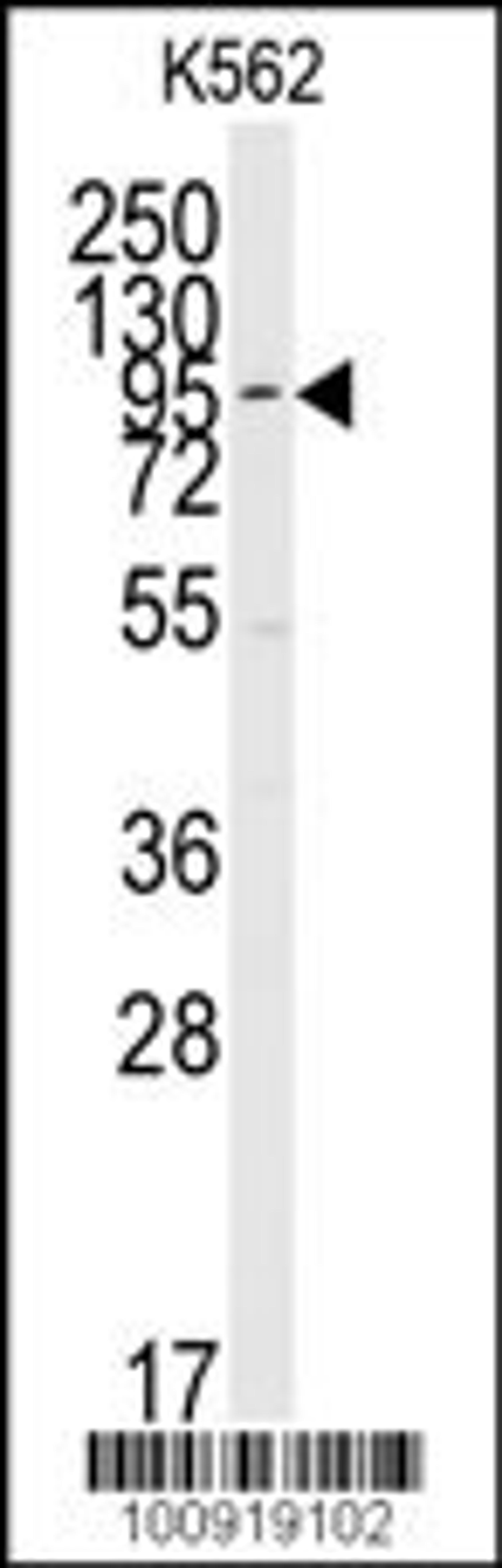 Western blot analysis of anti-ERK5 C-term Pab in K562 cell line lysates (35ug/lane)