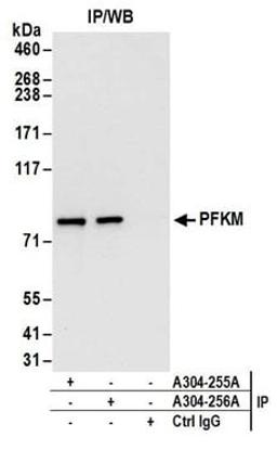 Detection of human PFKM by western blot of immunoprecipitates.