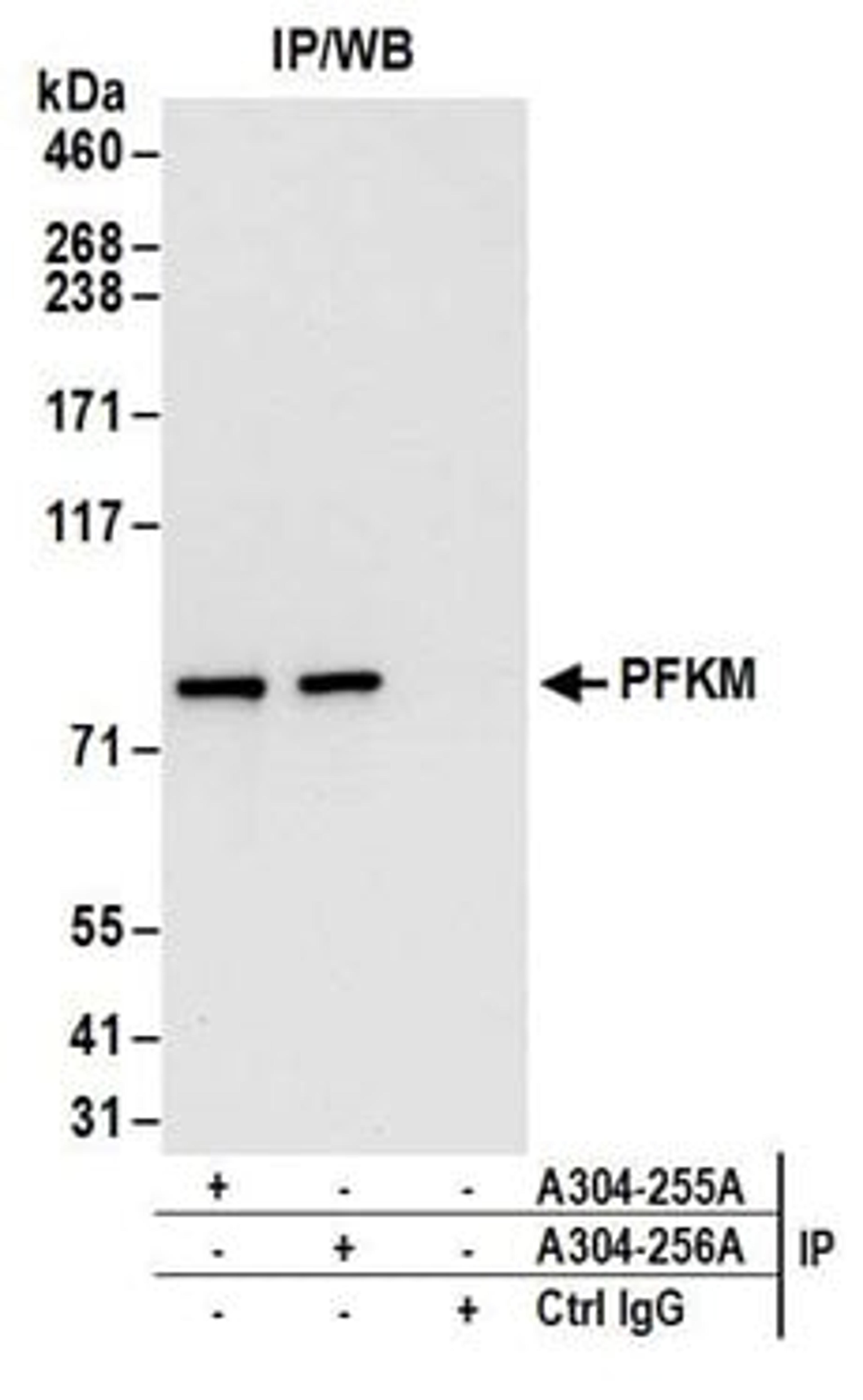 Detection of human PFKM by western blot of immunoprecipitates.