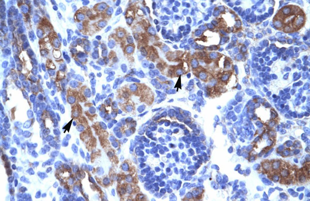 Antibody used in IHC on Human kidney.