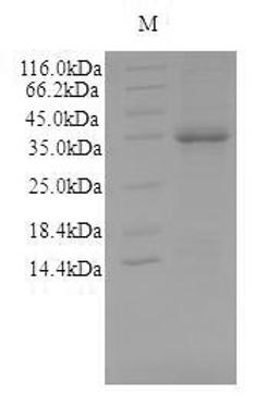 (Tris-Glycine gel) Discontinuous SDS-PAGE (reduced) with 5% enrichment gel and 15% separation gel.