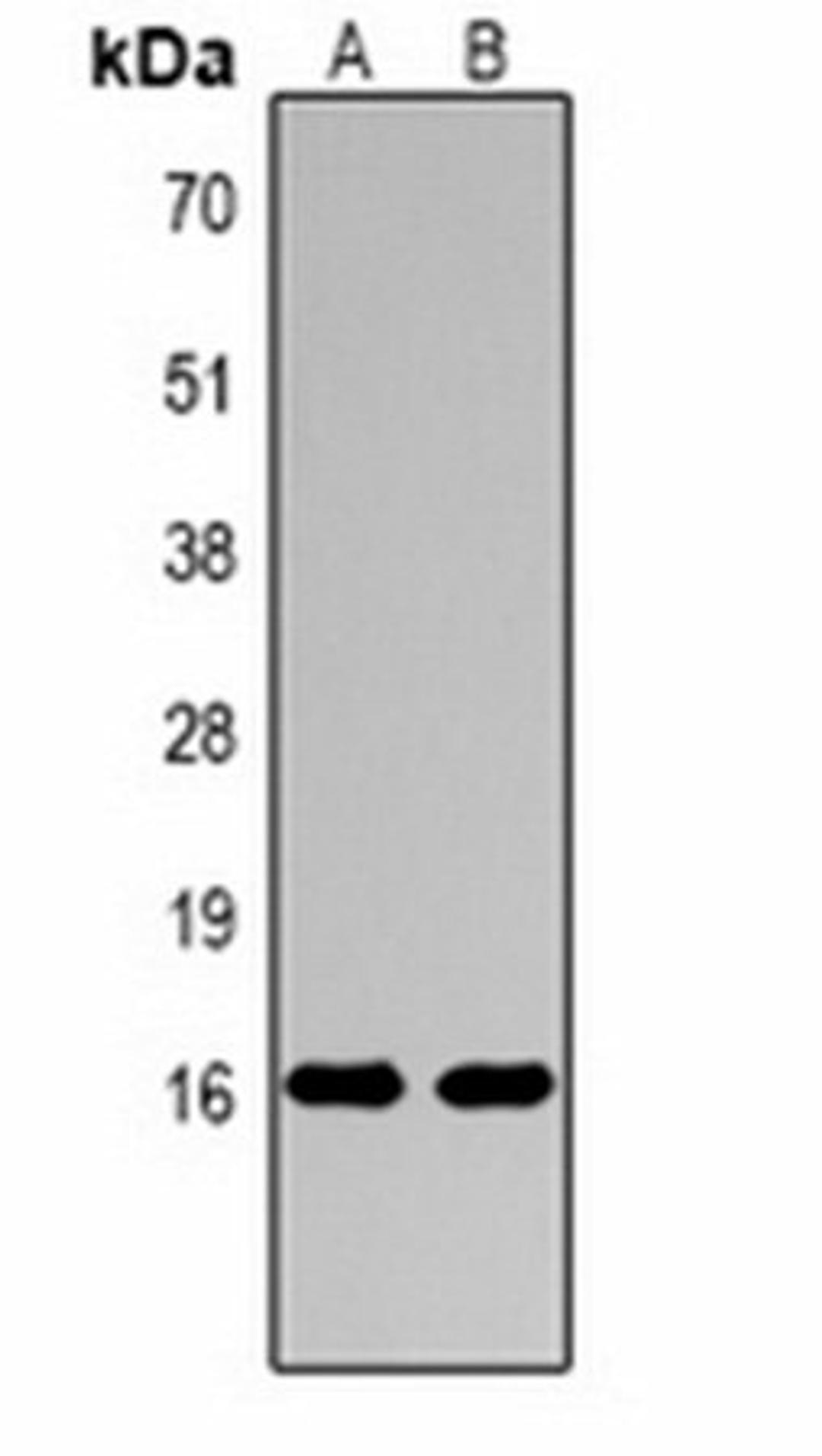 Western blot analysis of  Hela (Lane1), rat testis (Lane2) whole cell lysates using Histone H3 (MonoMethyl R17) antibody