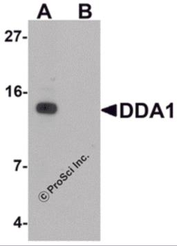 Western blot analysis of DDA1 in mouse heart tissue lysate with DDA1 antibody at 1 &#956;g/mL in (A) the absence and (B) the presence of blocking peptide