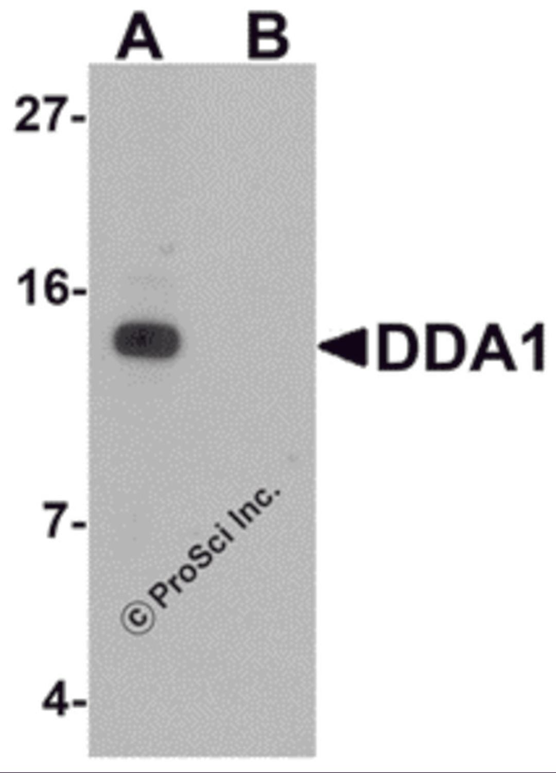 Western blot analysis of DDA1 in mouse heart tissue lysate with DDA1 antibody at 1 μg/mL in (A) the absence and (B) the presence of blocking peptide