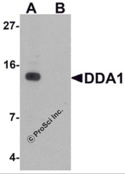 Western blot analysis of DDA1 in mouse heart tissue lysate with DDA1 antibody at 1 μg/mL in (A) the absence and (B) the presence of blocking peptide
