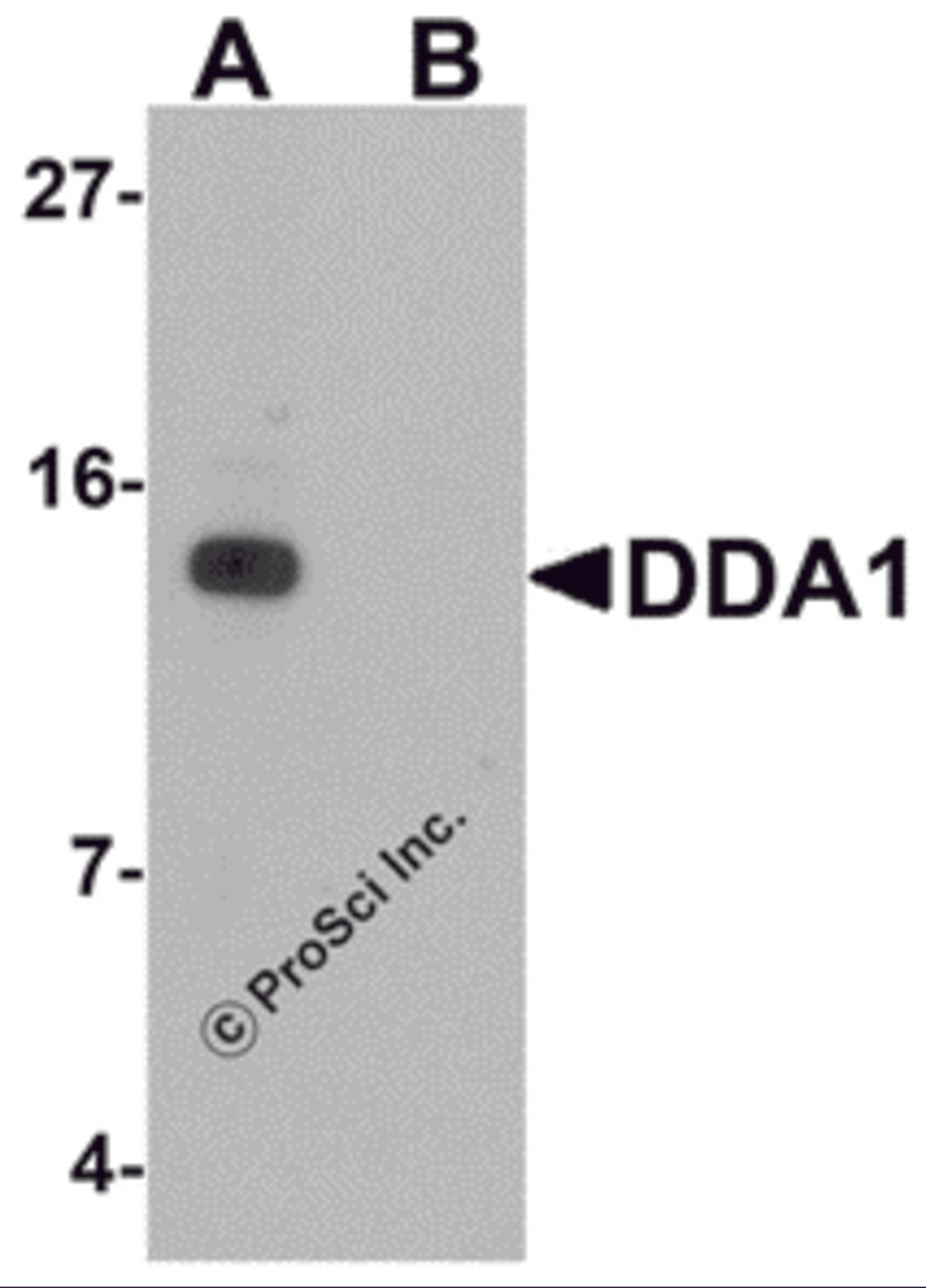 Western blot analysis of DDA1 in mouse heart tissue lysate with DDA1 antibody at 1 μg/mL in (A) the absence and (B) the presence of blocking peptide