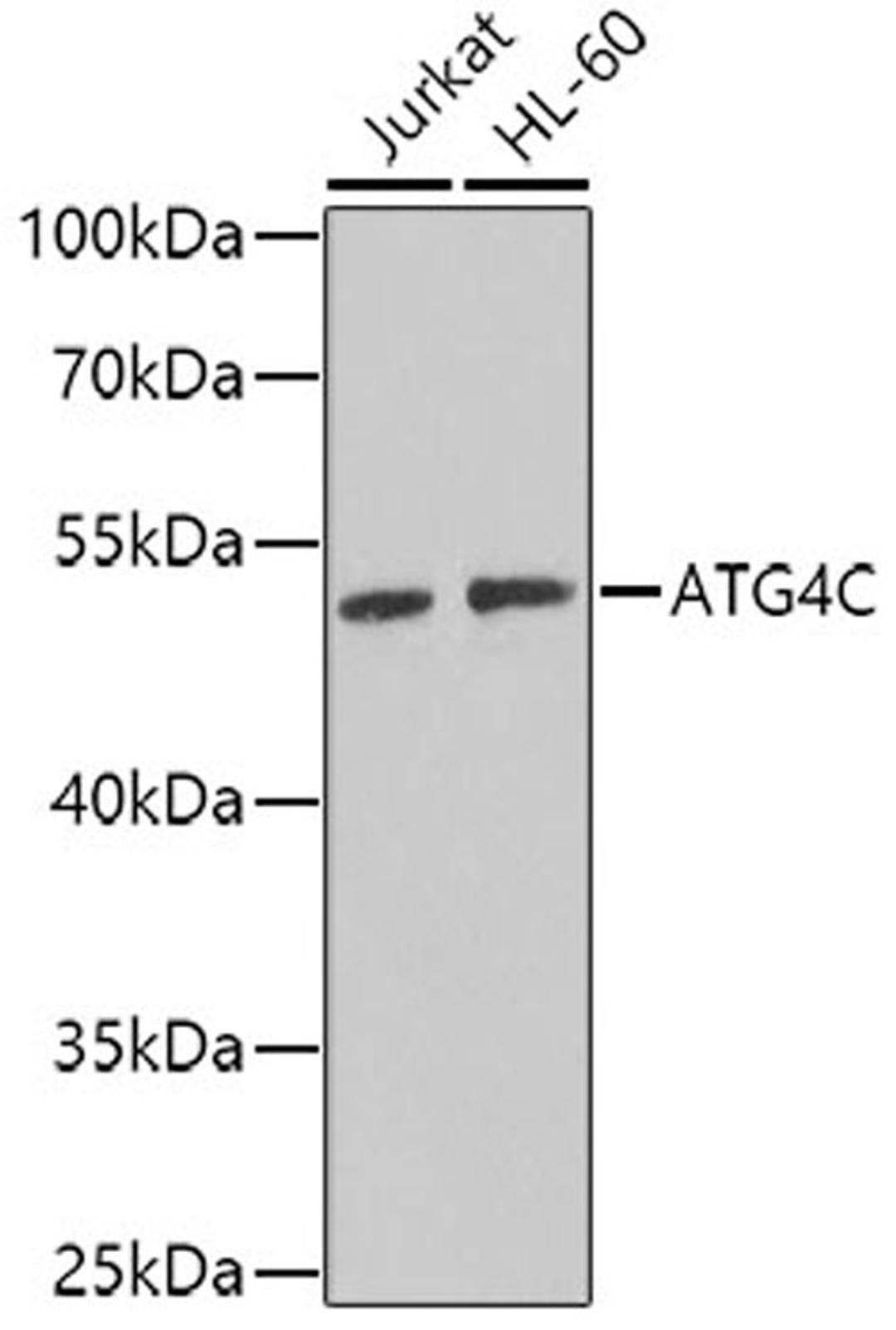 Western blot - ATG4C antibody (A7396)