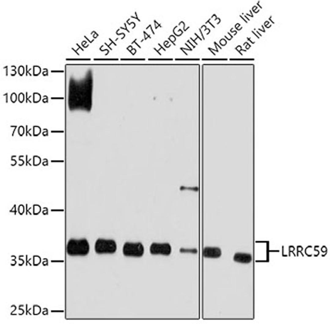 Western blot - LRRC59 antibody (A10022)