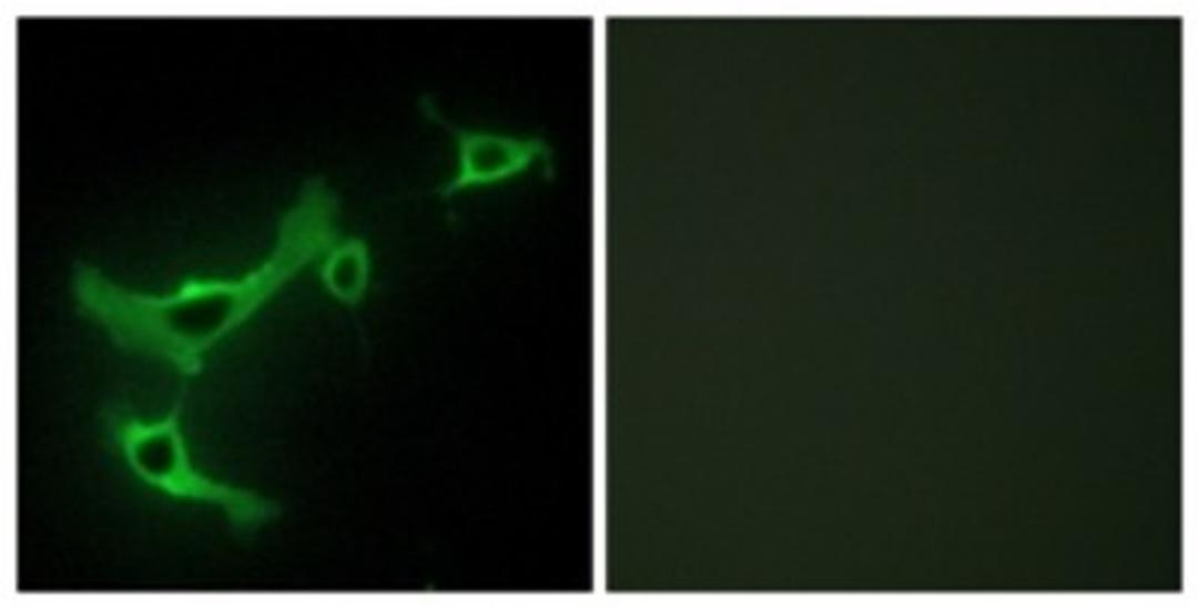 Immunocytochemistry/Immunofluorescence: TRIM3/BERP Antibody [NBP1-67793] - Analysis of NIH-3T3 cells, using TRIM3/BERP Antibody. The picture on the right is treated with the synthesized peptide.