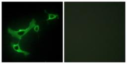 Immunocytochemistry/Immunofluorescence: TRIM3/BERP Antibody [NBP1-67793] - Analysis of NIH-3T3 cells, using TRIM3/BERP Antibody. The picture on the right is treated with the synthesized peptide.