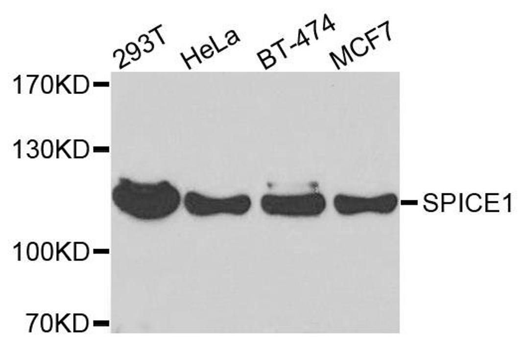 Western blot analysis of extracts of various cells using SPICE1 antibody