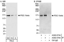 Detection of human PGC-1beta by western blot and immunoprecipitation.