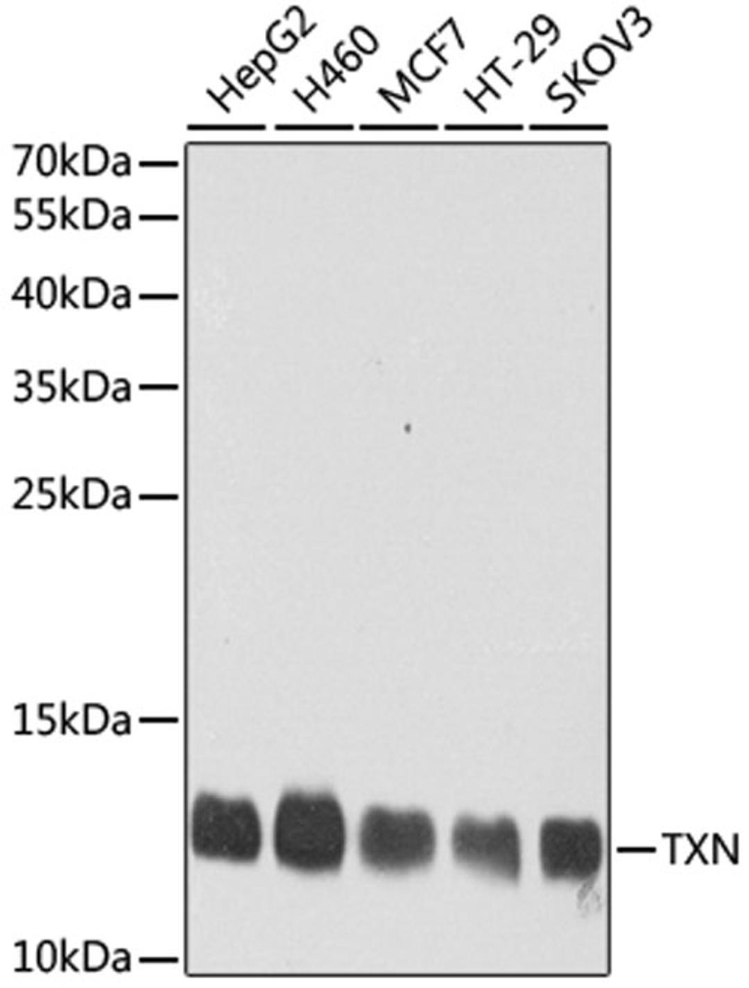 Western blot - TXN antibody (A7638)