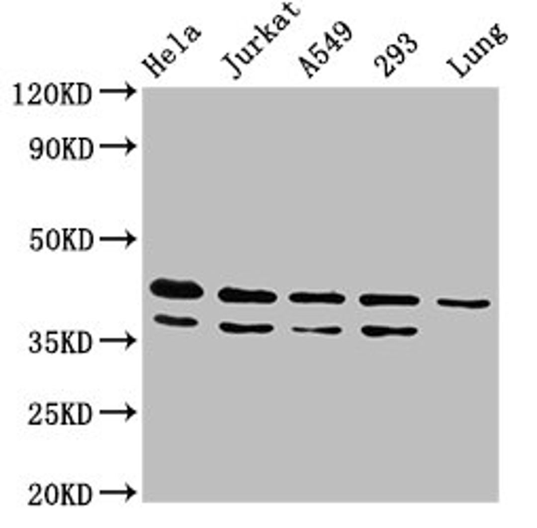 Western Blot. Positive WB detected in: Hela whole cell lysate, Jurkat whole cell lysate, A549 whole cell lysate, 293 whole cell lysate, Rat lung tissue. All lanes: MAPK1 antibody at 4.8ug/ml. Secondary. Goat polyclonal to rabbit IgG at 1/50000 dilution. Predicted band size: 42, 37 kDa. Observed band size: 42, 37 kDa. 