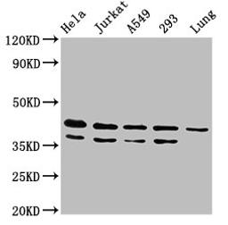 Western Blot. Positive WB detected in: Hela whole cell lysate, Jurkat whole cell lysate, A549 whole cell lysate, 293 whole cell lysate, Rat lung tissue. All lanes: MAPK1 antibody at 4.8ug/ml. Secondary. Goat polyclonal to rabbit IgG at 1/50000 dilution. Predicted band size: 42, 37 kDa. Observed band size: 42, 37 kDa. 