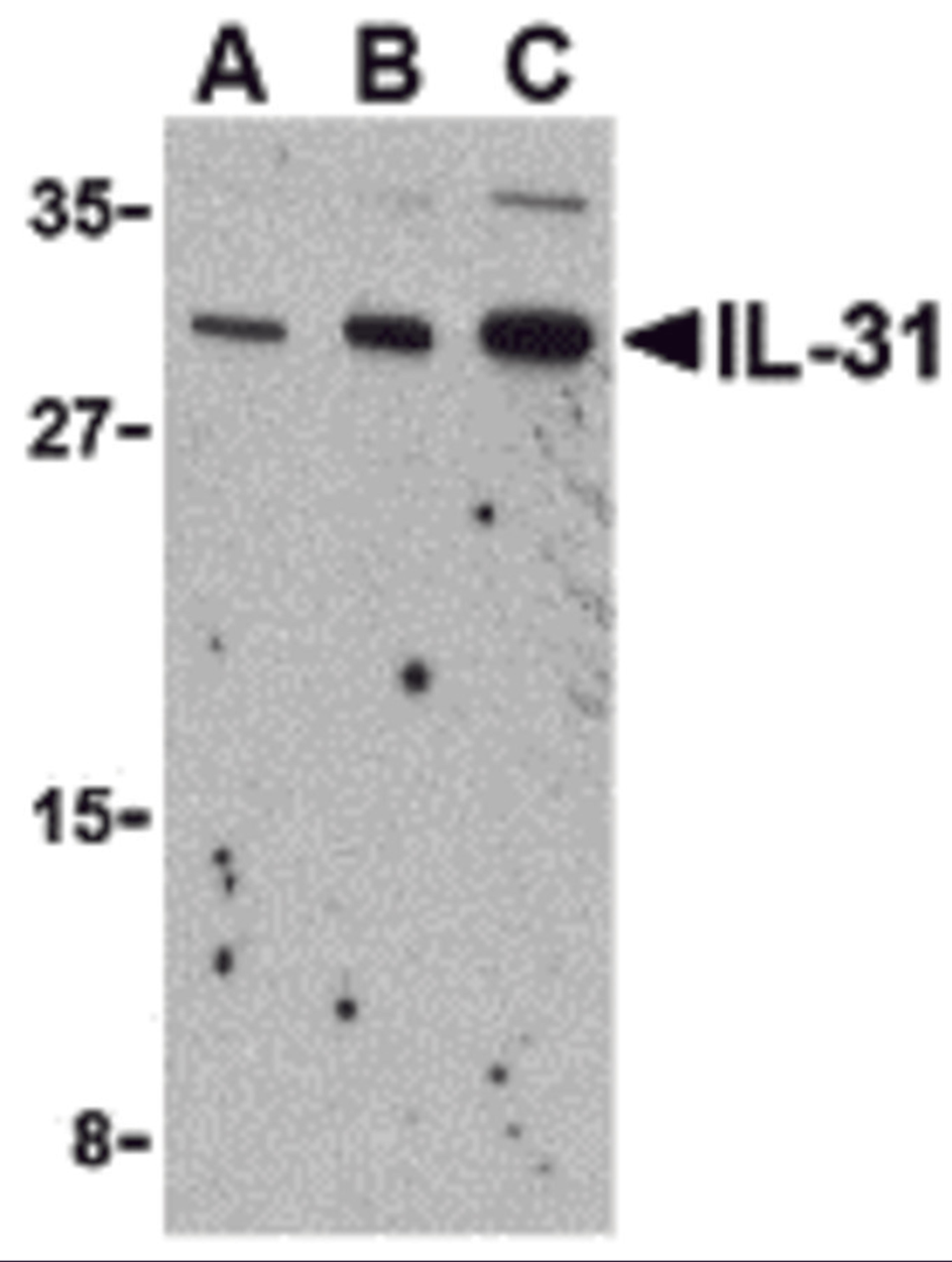 Western blot analysis of IL-31 in RAW264.7 cell lysate with IL-31 antibody at (A) 2.5, (B) 5 and (C) 10 &#956;g/mL. 