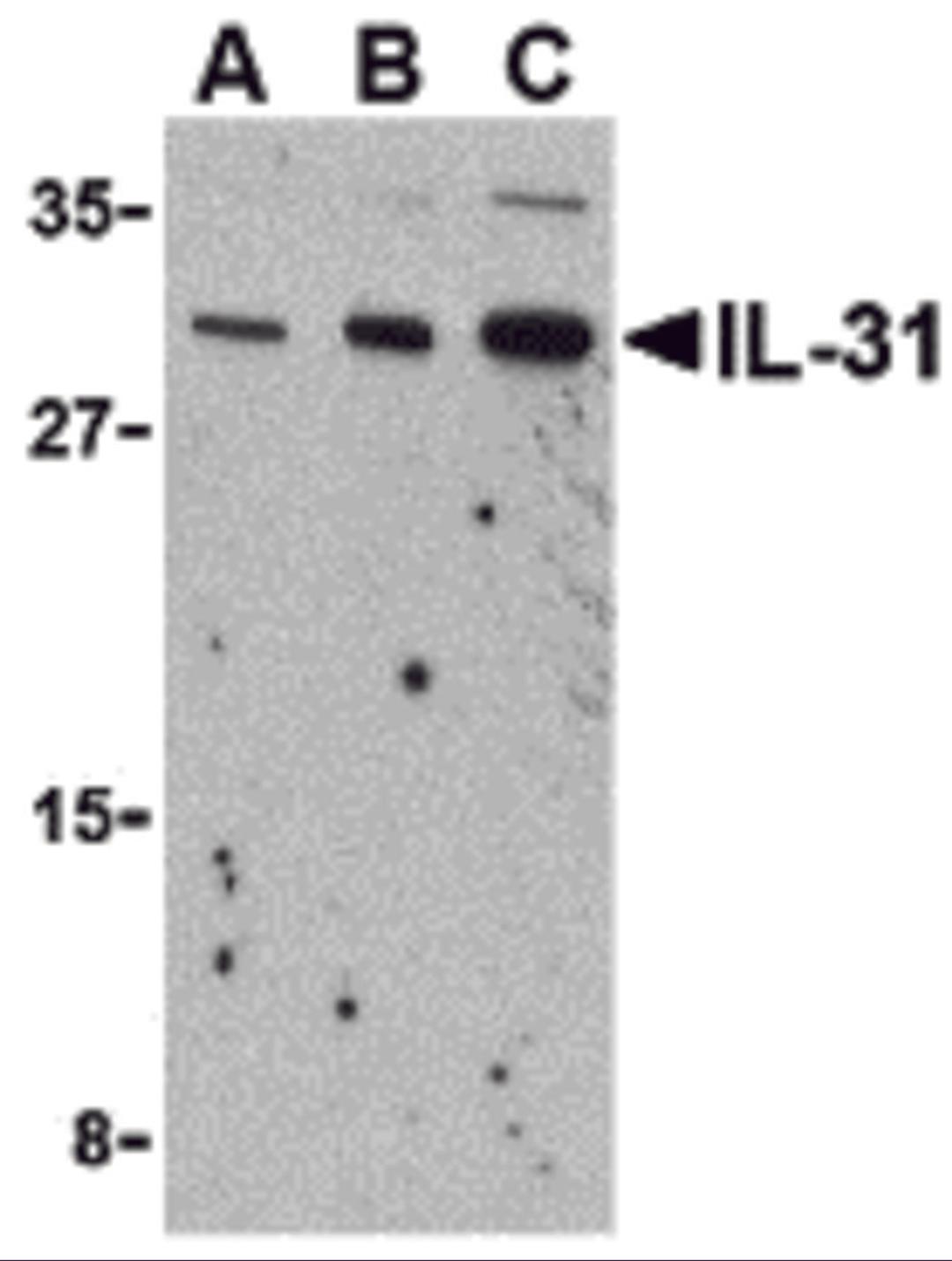 Western blot analysis of IL-31 in RAW264.7 cell lysate with IL-31 antibody at (A) 2.5, (B) 5 and (C) 10 μg/mL.