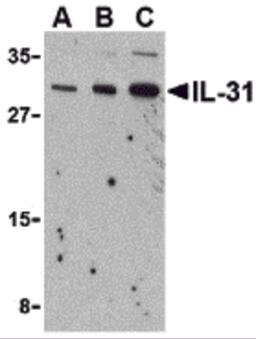 Western blot analysis of IL-31 in RAW264.7 cell lysate with IL-31 antibody at (A) 2.5, (B) 5 and (C) 10 μg/mL.