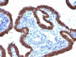 Immunohistochemical staining of human Fallopian Tube tissue using ASRGL1 antibody