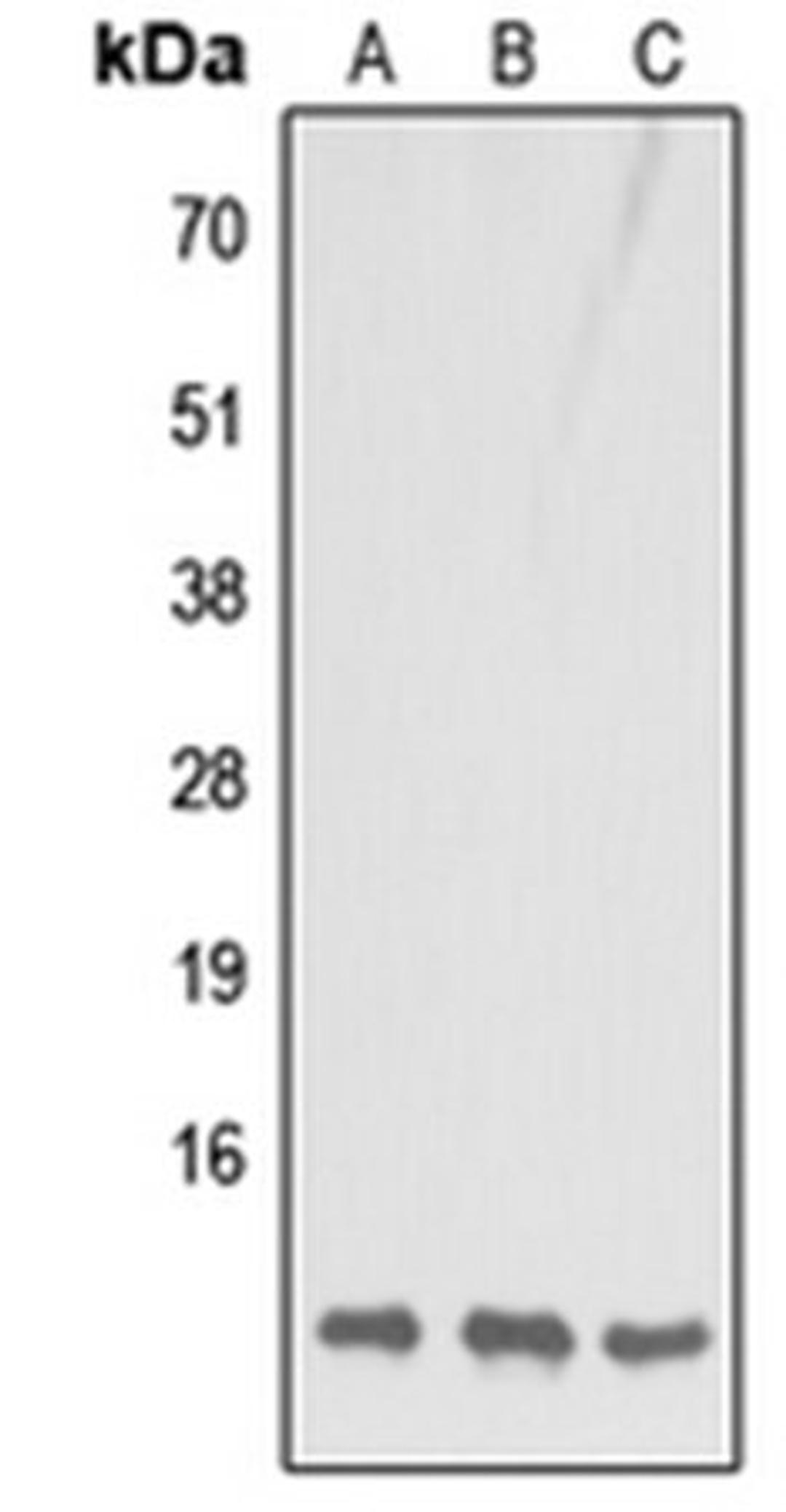 Western blot analysis of HeLa (Lane1), Raw264.7 (Lane2), H9C2 (Lane3) whole cell using COX7B1 antibody