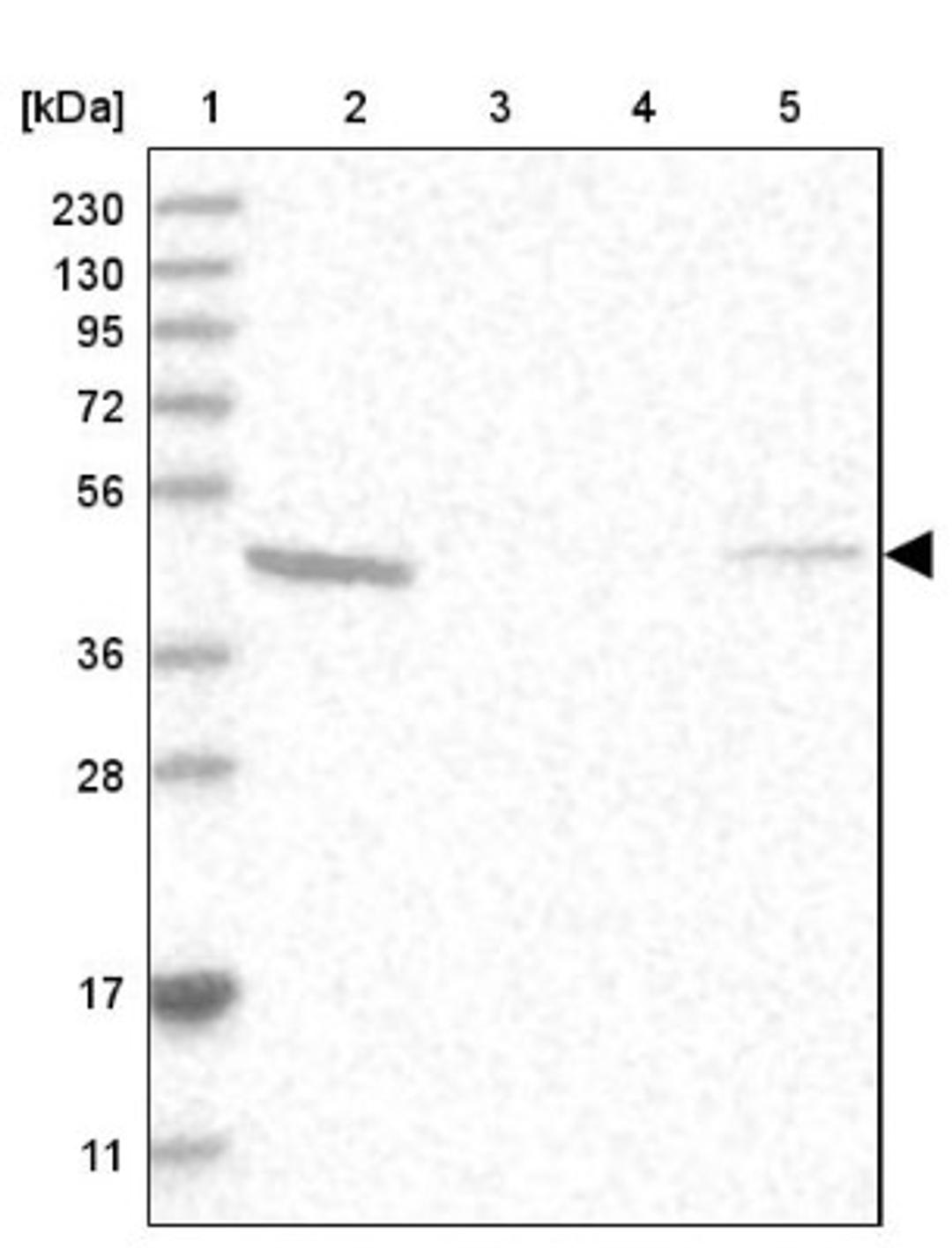 Western Blot: UBE2U Antibody [NBP1-81098] - Lane 1: Marker [kDa] 230, 130, 95, 72, 56, 36, 28, 17, 11<br/>Lane 2: Human cell line RT-4<br/>Lane 3: Human cell line U-251MG sp<br/>Lane 4: Human plasma (IgG/HSA depleted)<br/>Lane 5: Human liver tissue