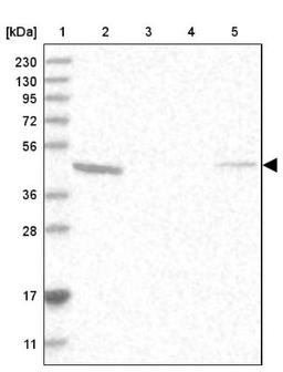 Western Blot: UBE2U Antibody [NBP1-81098] - Lane 1: Marker [kDa] 230, 130, 95, 72, 56, 36, 28, 17, 11<br/>Lane 2: Human cell line RT-4<br/>Lane 3: Human cell line U-251MG sp<br/>Lane 4: Human plasma (IgG/HSA depleted)<br/>Lane 5: Human liver tissue