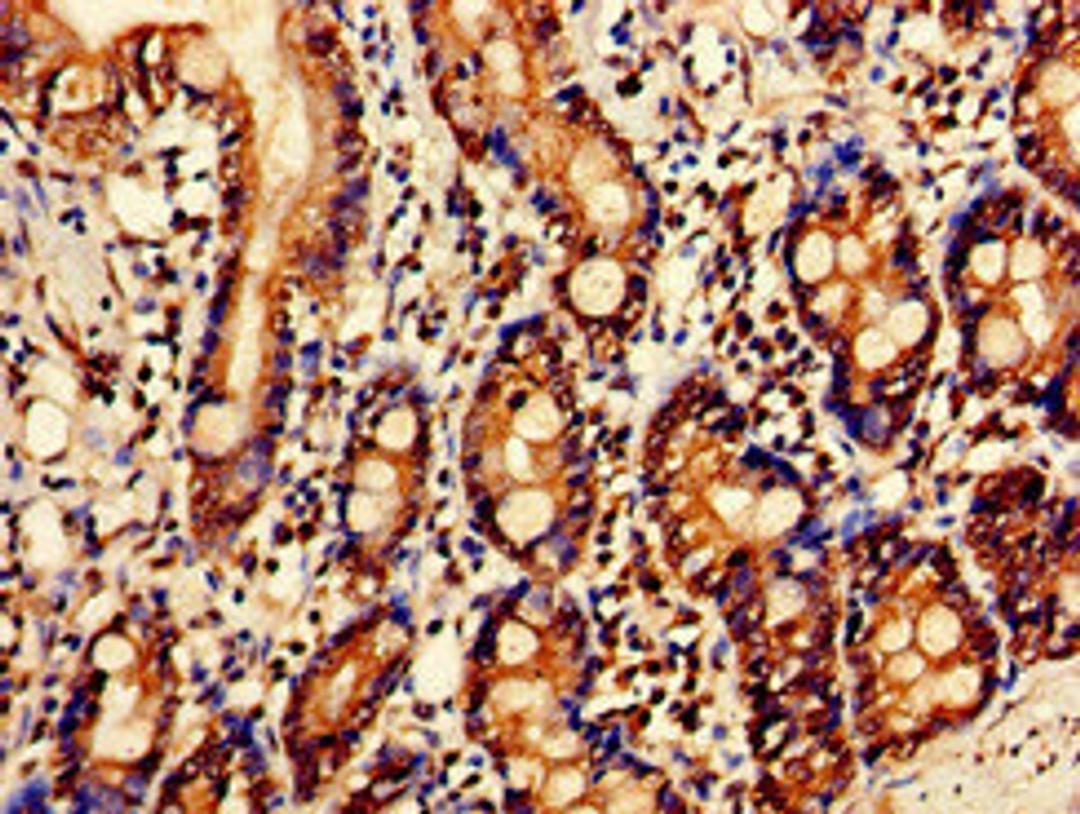 Immunohistochemistry of paraffin-embedded human small intestine tissue using CSB-PA021079LA01HU at dilution of 1:100