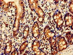 Immunohistochemistry of paraffin-embedded human small intestine tissue using CSB-PA021079LA01HU at dilution of 1:100
