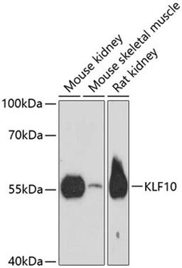 Western blot - KLF10 antibody (A13180)