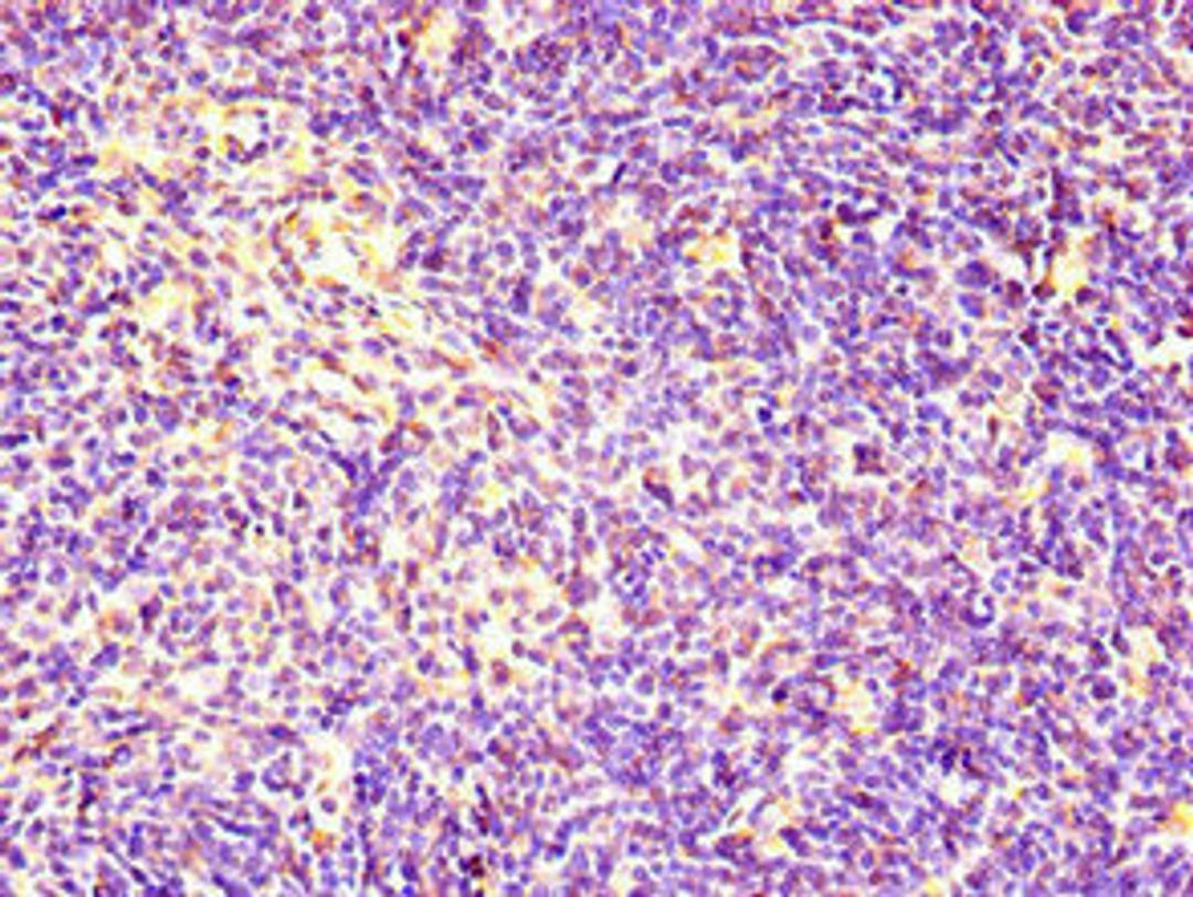 Immunohistochemistry of paraffin-embedded human thymus tissue using CSB-PA884432LA01HU at dilution of 1:100