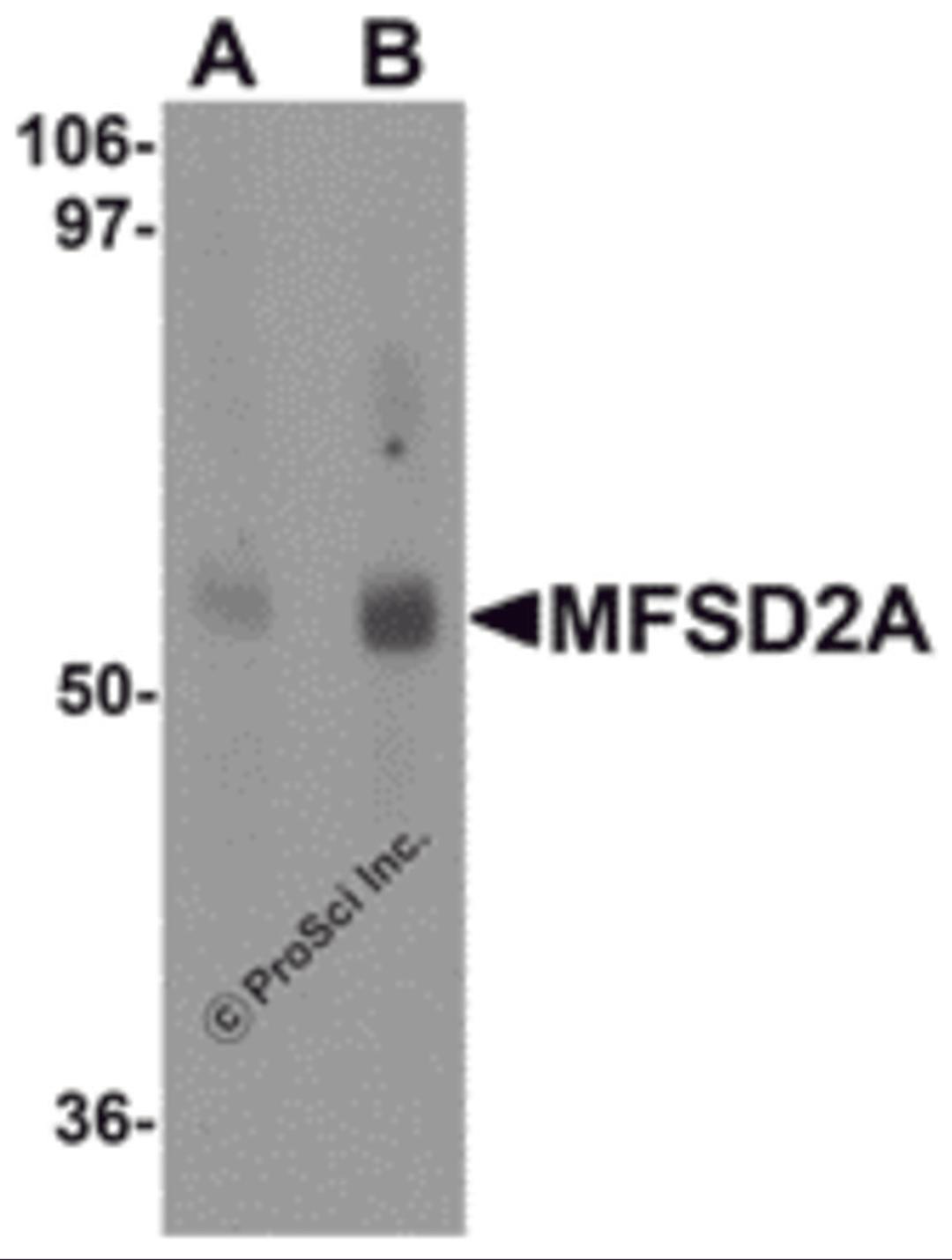 Western blot analysis of MFSD2A in rat lung tissue lysate with MFSD2A antibody at (A) 1 and (B) 2 &#956;g/mL.