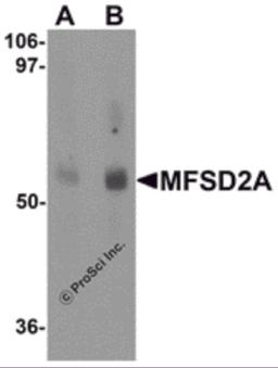 Western blot analysis of MFSD2A in rat lung tissue lysate with MFSD2A antibody at (A) 1 and (B) 2 μg/mL.