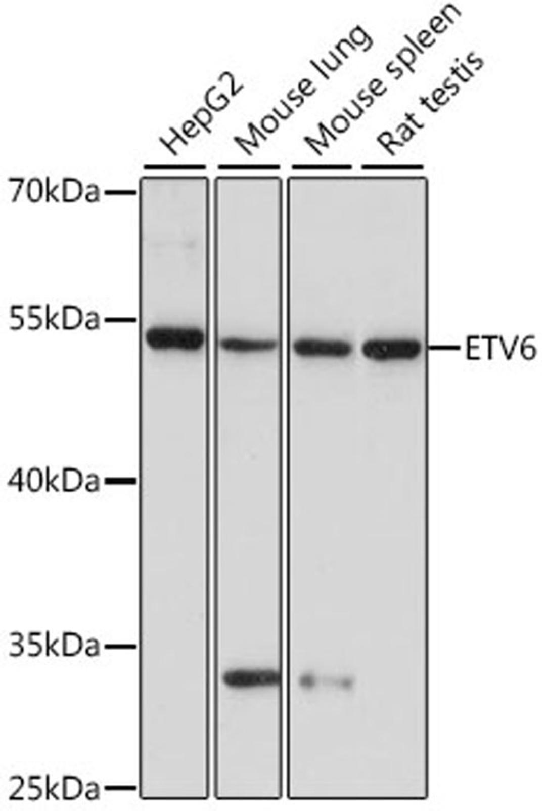 Western blot - ETV6 antibody (A15668)