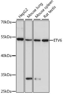 Western blot - ETV6 antibody (A15668)