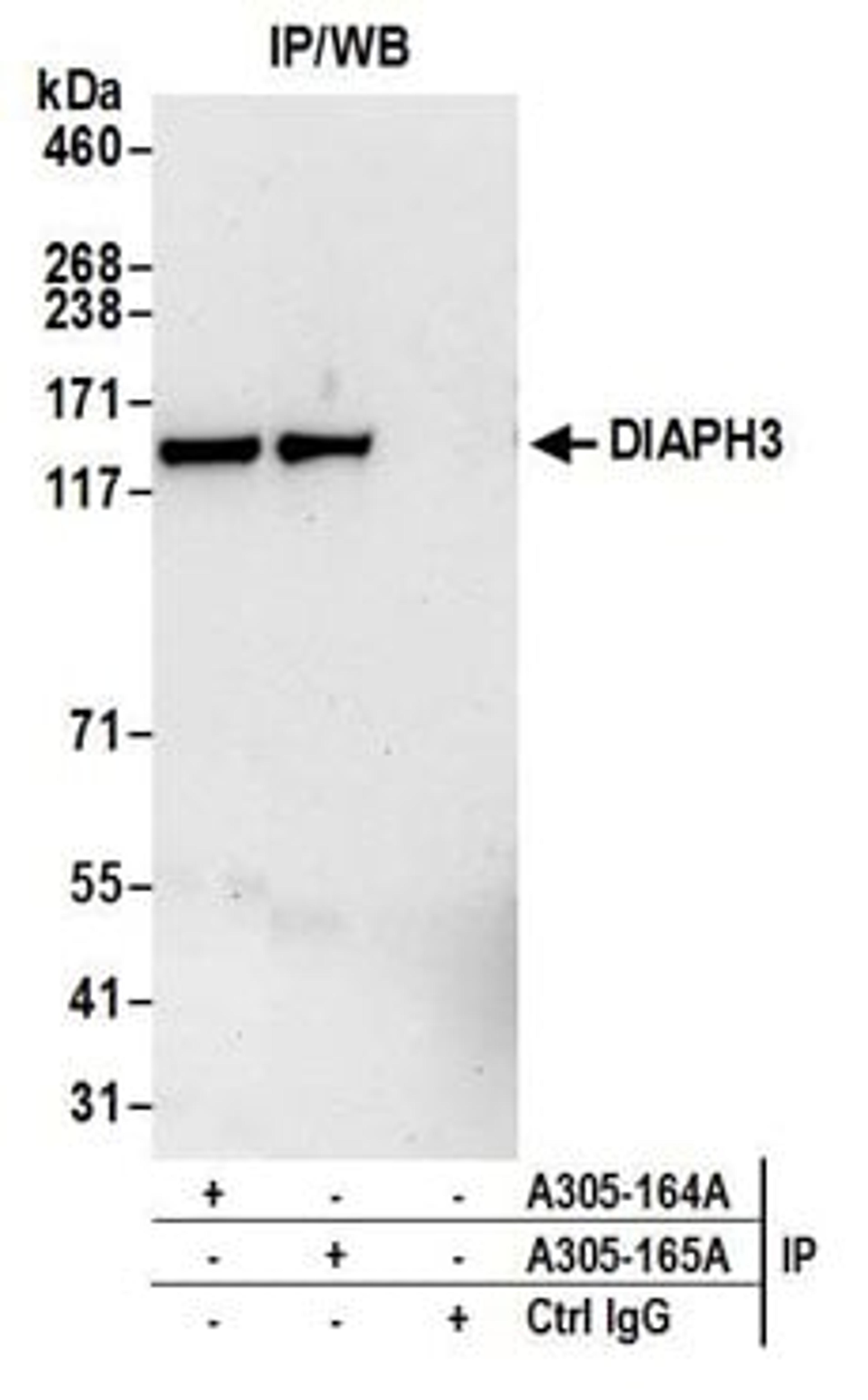 Detection of human DIAPH3 by western blot of immunoprecipitates.