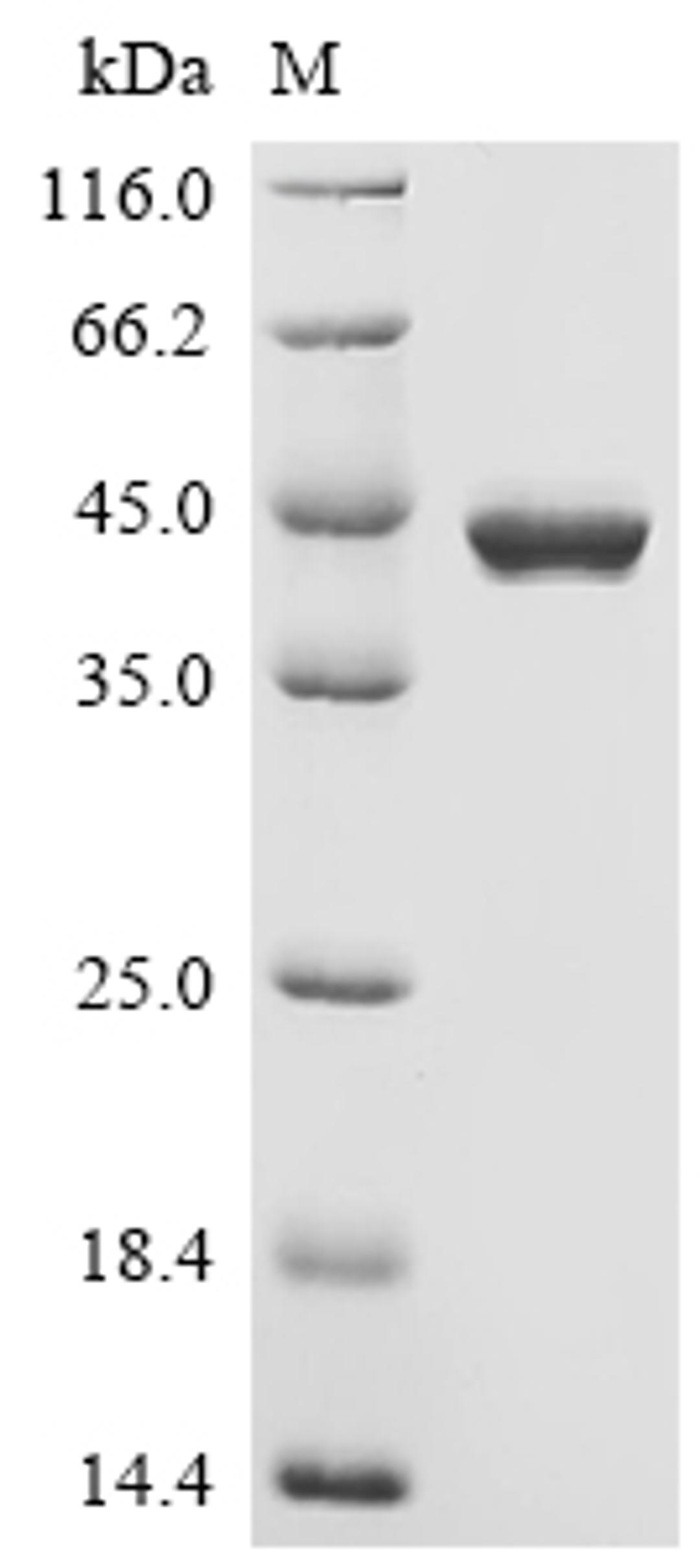 (Tris-Glycine gel) Discontinuous SDS-PAGE (reduced) with 5% enrichment gel and 15% separation gel.