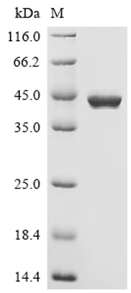 (Tris-Glycine gel) Discontinuous SDS-PAGE (reduced) with 5% enrichment gel and 15% separation gel.